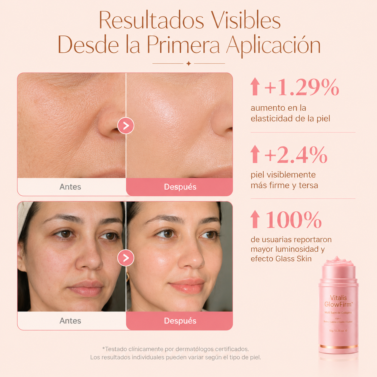 ✨Vitalis GlowFirm™ - El Multi Balm Coreano de Colágeno que Firma, Ilumina y Rejuvenece tu Rostro + ¡Paga 1 y Llévate 2! SOLO HOY🔥