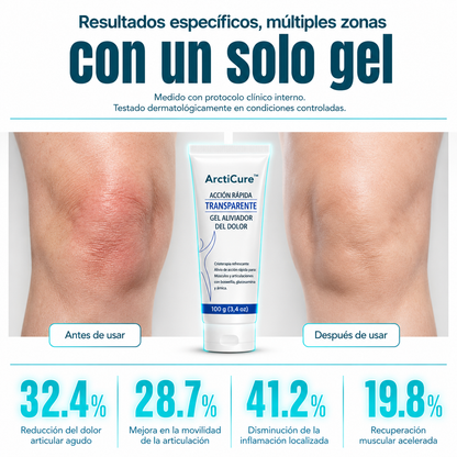 ArctiCure™ - Gel Masajeador Antiinflamatorio para los Dolores del Cuerpo + ¡OFERTA 2×1  SOLO HOY! 🔥