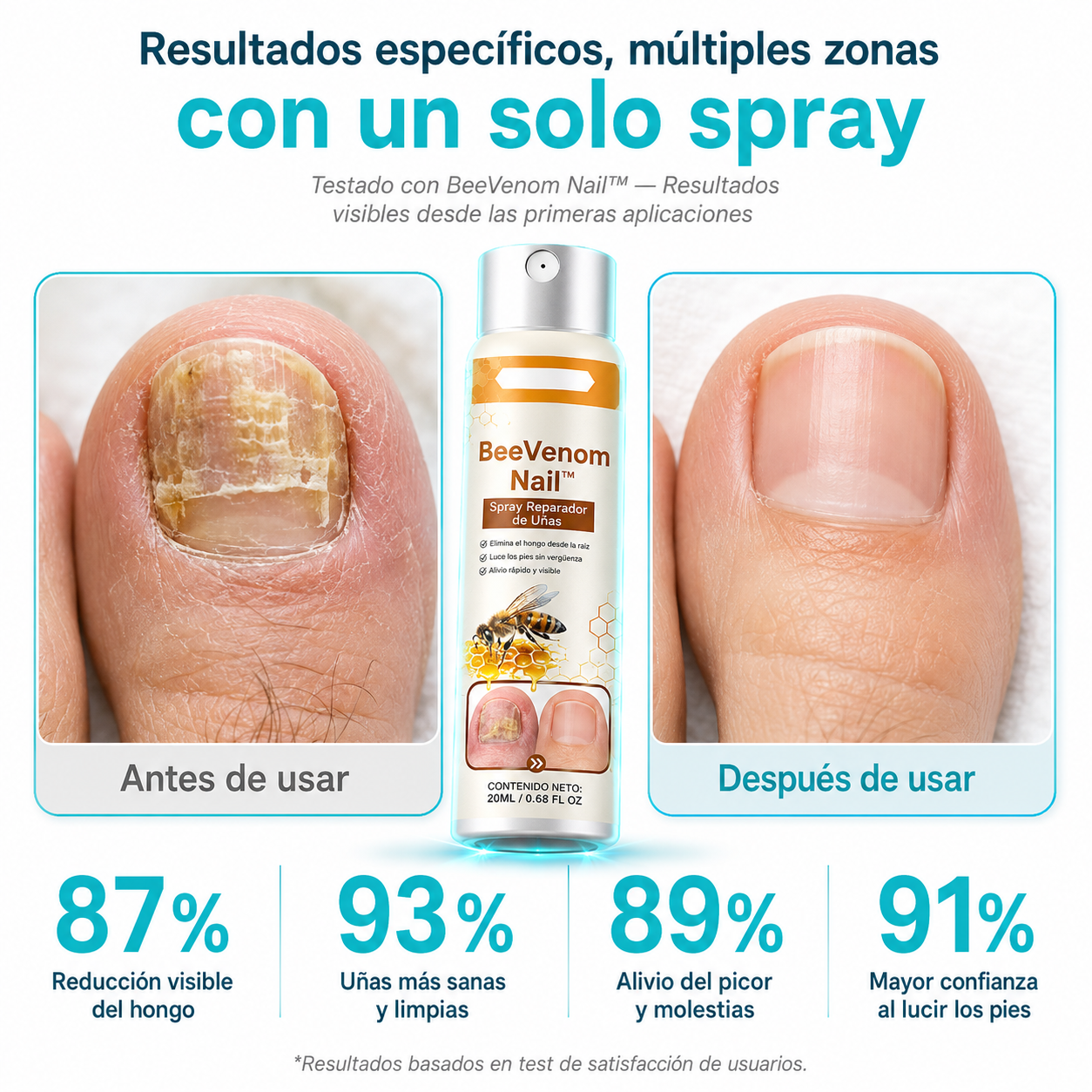 🐝 BeeVenom Nail™ - Spray Reparador de Uñas + ¡Paga 1 y Llévate 2! SOLO HOY🔥