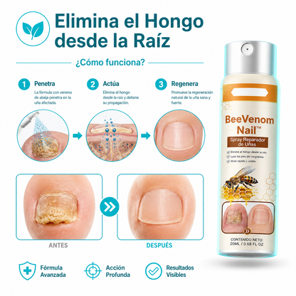 🐝 BeeVenom Nail™ - Spray Reparador de Uñas + ¡Paga 1 y Llévate 2! SOLO HOY🔥